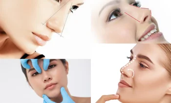 İstanbul'da Burun Estetiği - Rhinoplasty in İstanbul Yapan Yerler Var Mıdır?