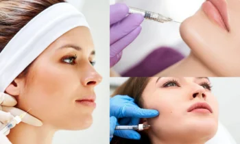 Çene Botoksu Tedavi Süreci Nasıl Başlar?