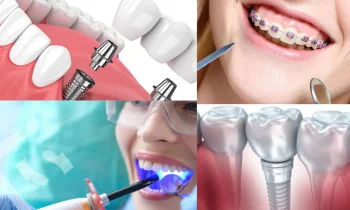 Düzce Gülüş Tasarımı Nasıl Yapılır?